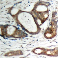 Plakophilin 2 Rabbit Polyclonal Antibody
