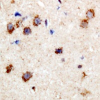 CPI17 (Phospho-T38) Rabbit Polyclonal Antibody