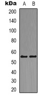 DOK2 Rabbit Polyclonal Antibody