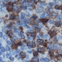 DOK2 Rabbit Polyclonal Antibody