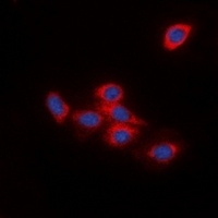 DOK2 Rabbit Polyclonal Antibody