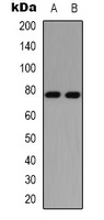 PKC delta (Phospho-S645) Rabbit Polyclonal Antibody