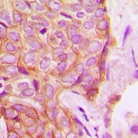 PKC delta (Phospho-S645) Rabbit Polyclonal Antibody