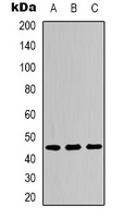 IKB epsilon (Phospho-S22) Rabbit Polyclonal Antibody