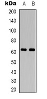 PAK2 Rabbit Polyclonal Antibody