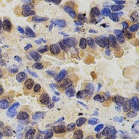 PAK2 Rabbit Polyclonal Antibody
