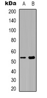 Septin 1 Rabbit Polyclonal Antibody