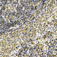 Septin 1 Rabbit Polyclonal Antibody