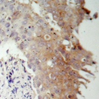 IRS1 Rabbit Polyclonal Antibody