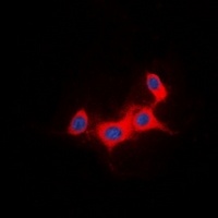 IRS1 Rabbit Polyclonal Antibody