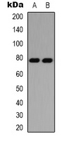 PKC delta Rabbit Polyclonal Antibody