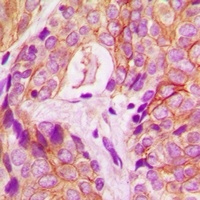 PKC delta Rabbit Polyclonal Antibody