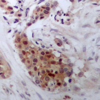STAT4 Rabbit Polyclonal Antibody