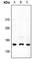 ATP7A Rabbit Polyclonal Antibody