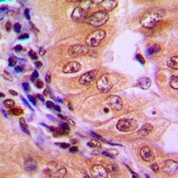 AMPK alpha 1 Rabbit Polyclonal Antibody