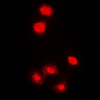 AMPK alpha 1 Rabbit Polyclonal Antibody