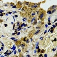 PLC gamma 1 Rabbit Polyclonal Antibody