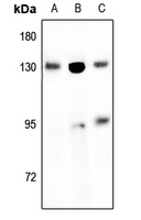 EPHB1/2 Rabbit Polyclonal Antibody