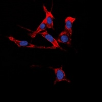 EPHB1/2 Rabbit Polyclonal Antibody