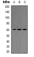 AKT2 (Phospho-S474) Rabbit Polyclonal Antibody