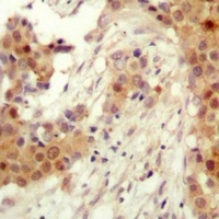 AKT2 (Phospho-S474) Rabbit Polyclonal Antibody