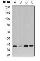 IKB alpha (Phospho-Y42) Rabbit Polyclonal Antibody