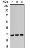 HSP27 (Phospho-S82) Antibody