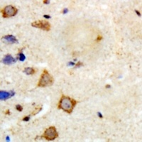 TRAF6 Antibody