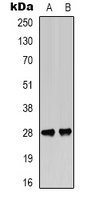 BCL2 (Phospho-T56) Rabbit Polyclonal Antibody
