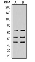 SHCA (Phospho-Y427) Rabbit Polyclonal Antibody