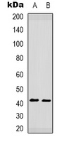 CCR5 (Phospho-S349) Antibody