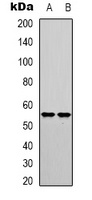 IRF3 (Phospho-S385) Antibody