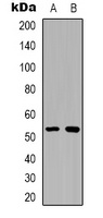 XIAP (Phospho-S87) Rabbit Polyclonal Antibody