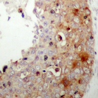 XIAP (Phospho-S87) Rabbit Polyclonal Antibody