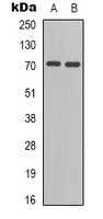 BLNK (Phospho-Y96) Rabbit Polyclonal Antibody