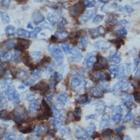 BLNK (Phospho-Y96) Rabbit Polyclonal Antibody