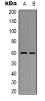 AKT (Phospho-Y326) Rabbit Polyclonal Antibody
