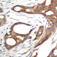 PER2 (Phospho-S662) Rabbit Polyclonal Antibody