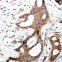 MSK1 (Phospho-S212) Rabbit Polyclonal Antibody