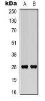 BCL2 (Phospho-S70) Rabbit Polyclonal Antibody