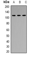 RB1 Rabbit Polyclonal Antibody