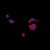 CD226 Rabbit Polyclonal Antibody