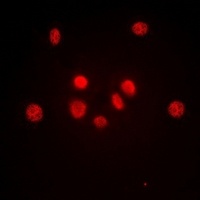 c-Jun Rabbit Polyclonal Antibody