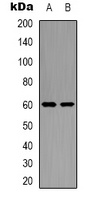 GRB10 Rabbit Polyclonal Antibody