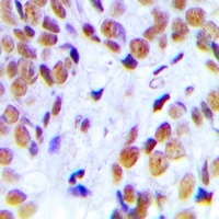 Nucleophosmin Rabbit Polyclonal Antibody