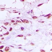 DNA Ligase 4 Rabbit Polyclonal Antibody