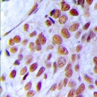 MRE11 Rabbit Polyclonal Antibody