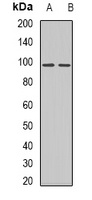 AXL Rabbit Polyclonal Antibody