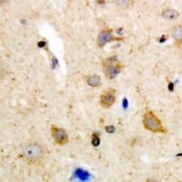 BLK Rabbit Polyclonal Antibody