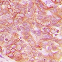 Claudin 3 Rabbit Polyclonal Antibody